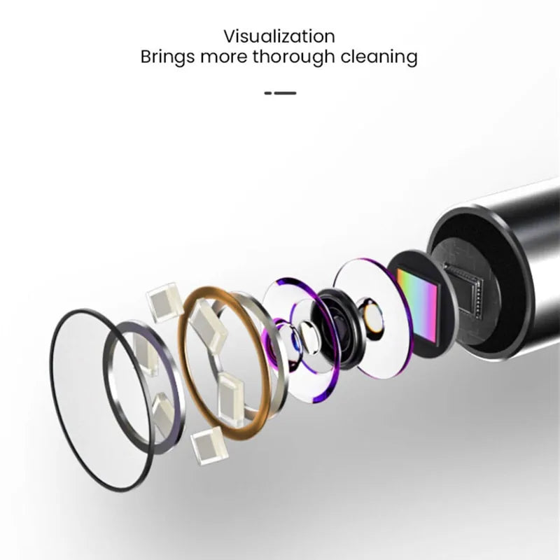 Intelligent Visual Ear Cleanser